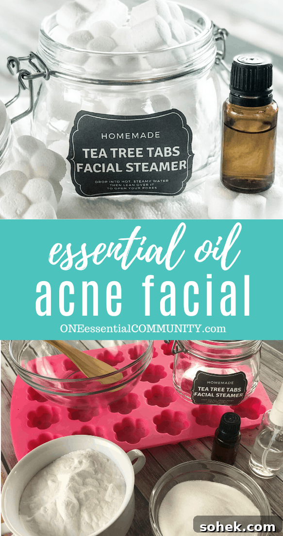 Tea Tree Acne Facial Tabs — Lush-Inspired Acne Treatment 11 essential oil acne facial image collage with flower shaped tea tree tabs facial steamer in open glass jar, essential oil bottle, title card, ingredients and tools collection tea tree essential oil witch hazel baking soda citric acid